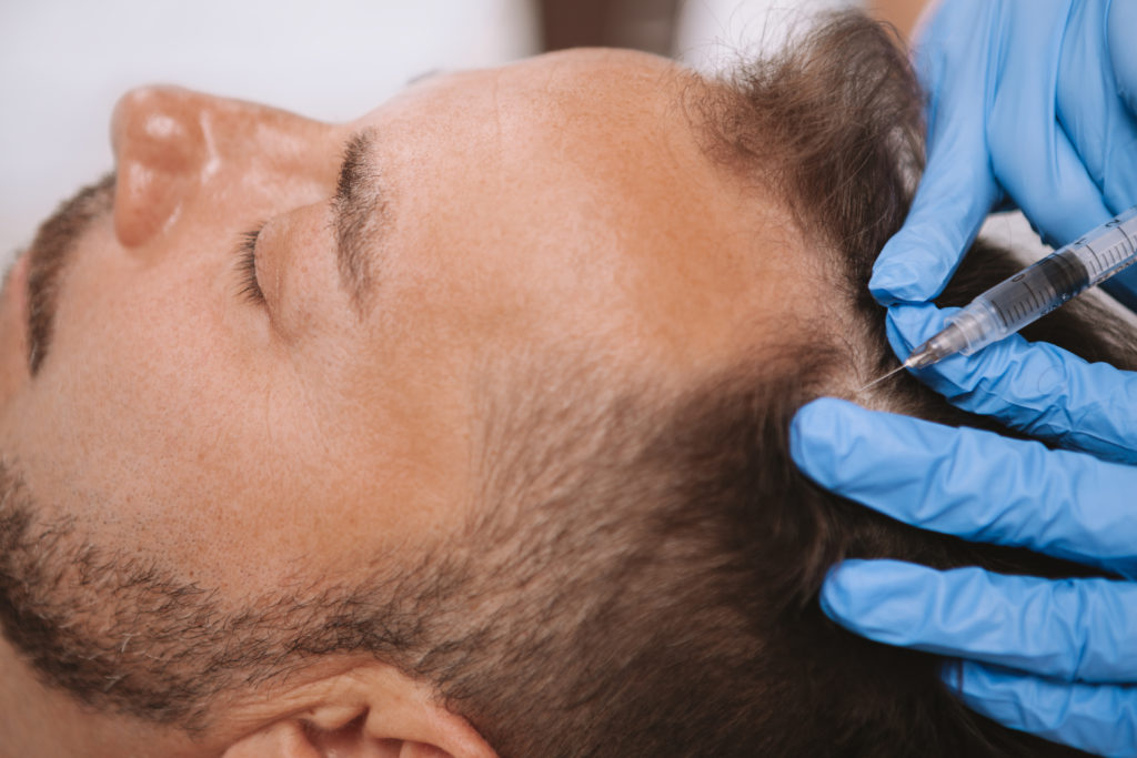 man getting hairloss treatment injections in thrive wellness | Cummings Hwy, Chattanooga, TN