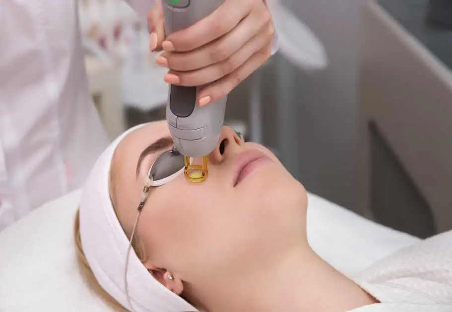 Erbium laser resurfacing treatment by Thrive Wellness in Chattanooga, TN