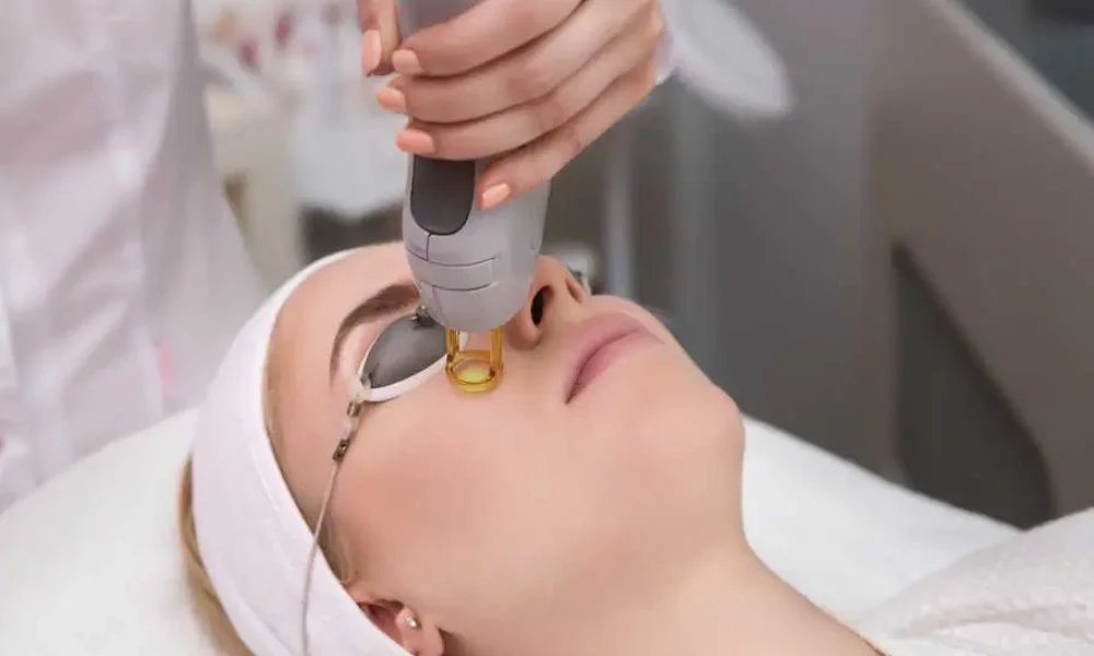 Erbium laser resurfacing treatment by Thrive Wellness in Chattanooga, TN